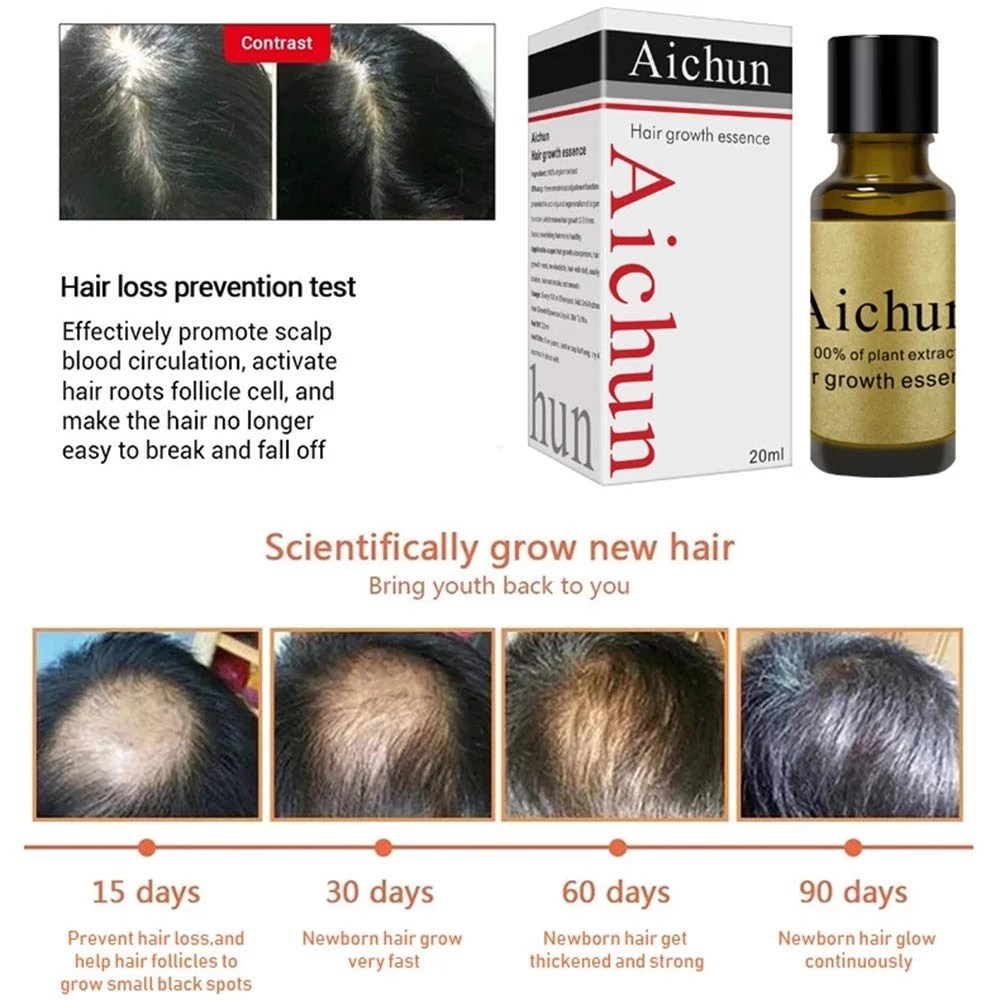 Aichun Beauty Hair Growth Essence oil