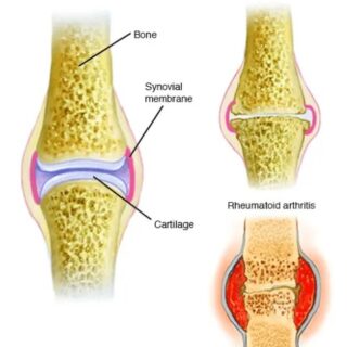 bone and cartilage