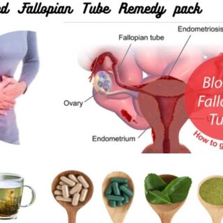 Blocked Fallopian Tube Remedy pack