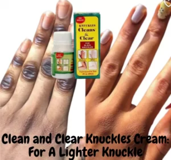 Clean and Clear Cream For Knuckles