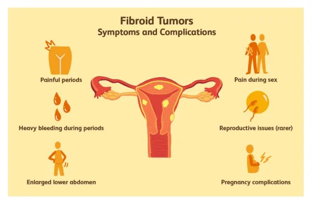 Fibroid Shrinker